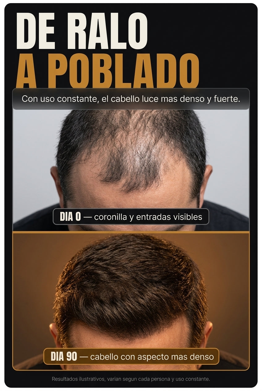 De ralo a poblado - dia 0 vs dia 90 densidad capilar