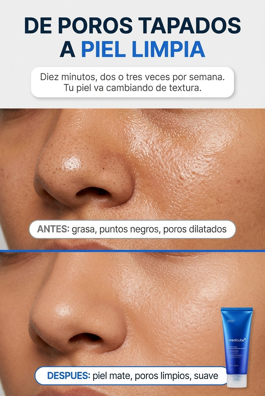 Antes y despues: de poros tapados a piel limpia